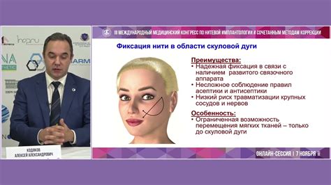 Преимущества и недостатки различных способов перевода