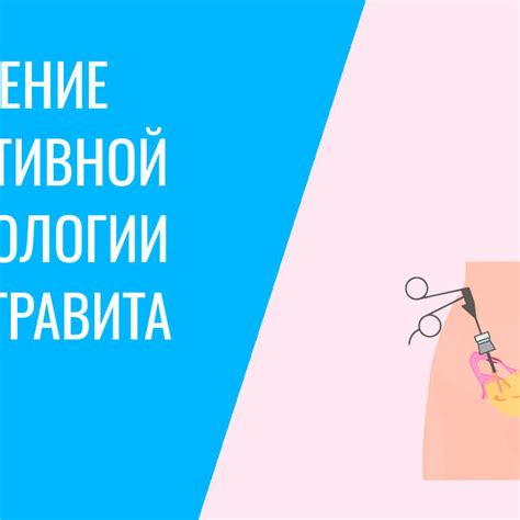 Преимущества лапароскопии маточных труб перед классической операцией