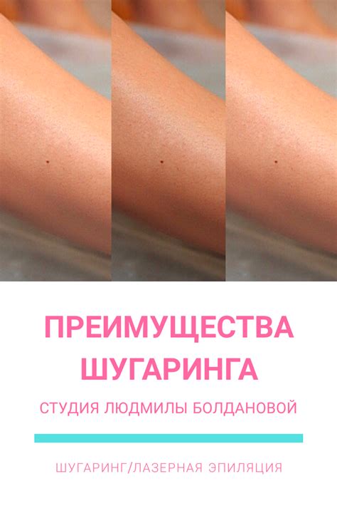 Преимущества самостоятельного шугаринга