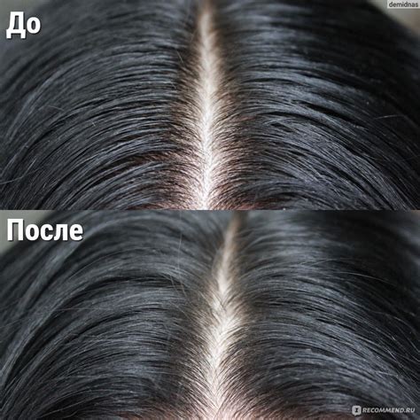 Преимущества сухого шампуня для окрашенных волос