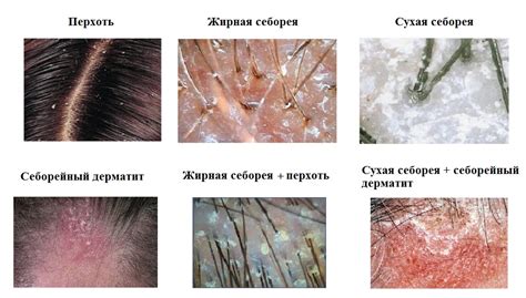 Прекрасное очищение и лечение кожи головы