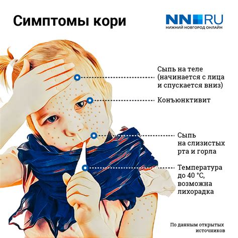Привитый от кори: новая опасность для непривитого ребенка