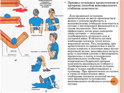 Приемы для остановки кровотечения
