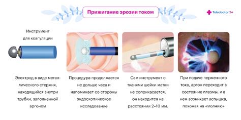 Прижигание эрозии после родов: необходимость и эффективность