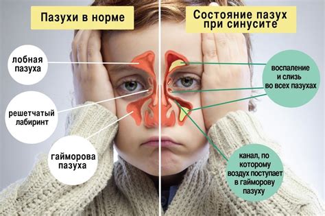 Признаки запрета промывания носа при повышенной температуре