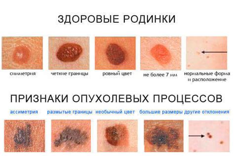 Признаки опасности на коже