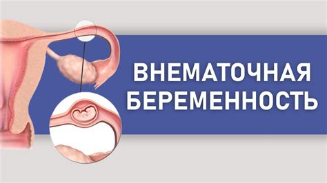 Признаки того, что пробка начинает отходить