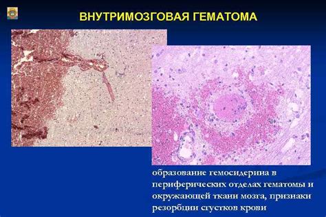 Признаки фолликульной резорбции