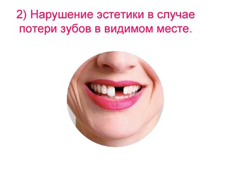 Примета или нарушение эстетики