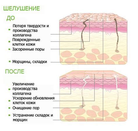 Принцип действия салициловой кислоты при прижигании раны