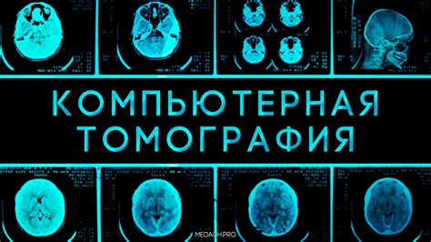 Принцип работы Компьютерной Томографии