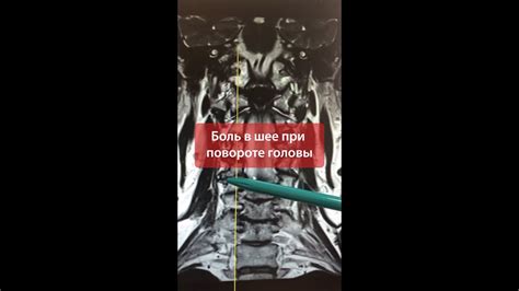 Причина неприятных ощущений при повороте и вытирании ребер