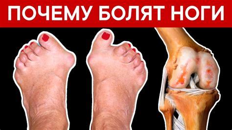 Причины болезненности левой ноги