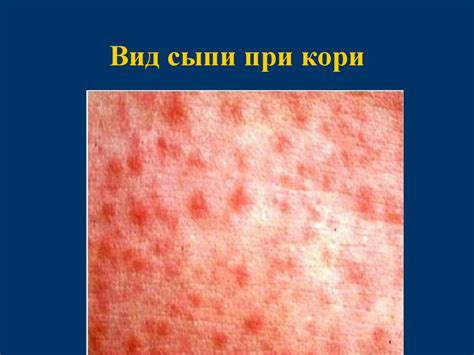 Причины возникновения сыпи при приеме боботика
