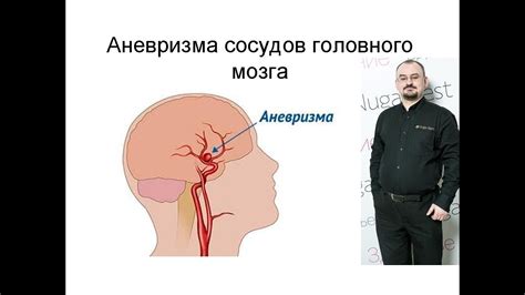 Причины головного уноса