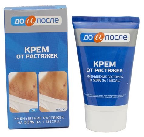 Причины использования крема от растяжек в определенное время