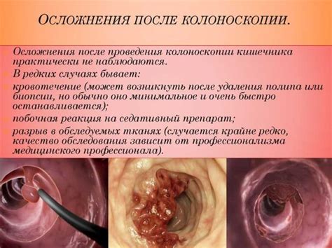 Причины и последствия прохождения колоноскопии