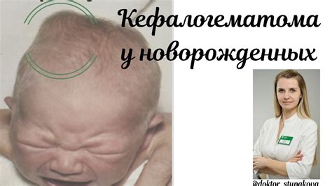 Причины лысости у новорожденных