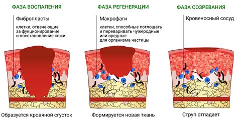 Причины ожога от йода