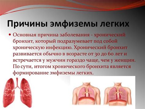 Причины повышения температуры при эмфиземе легких