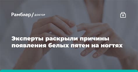 Причины появления белых пятен на ногах при стоянии и методы избавления от них