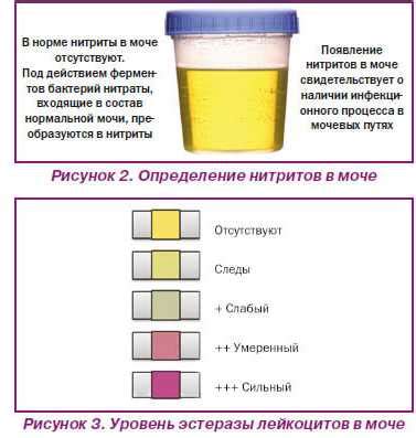 Причины появления желтой мочи у грудничка