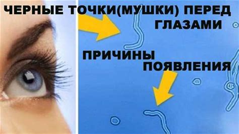 Причины появления желтых пятен перед глазами