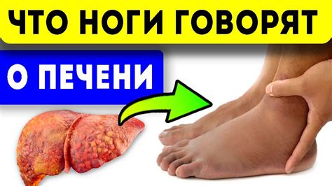 Причины появления красных пятен на ногах
