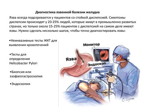 Причины развития язвы желудка