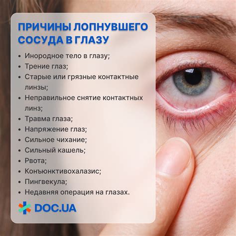 Причины разрыва сосуда в глазу