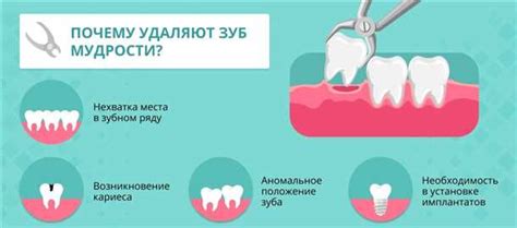 Причины удаления, последствия, рекомендации