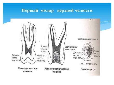 Проблемы с первым моляром верхней челюсти