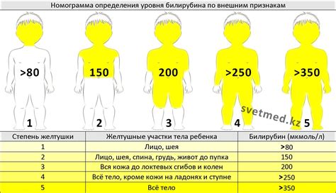 Продолжительность лечения желтушки новорожденных