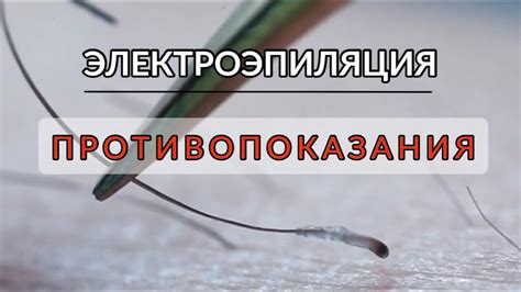 Противопоказания и последствия