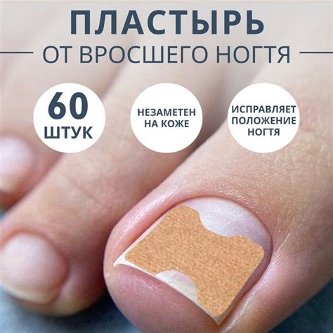 Профилактика вросшего ногтя: советы для здоровых ногтей