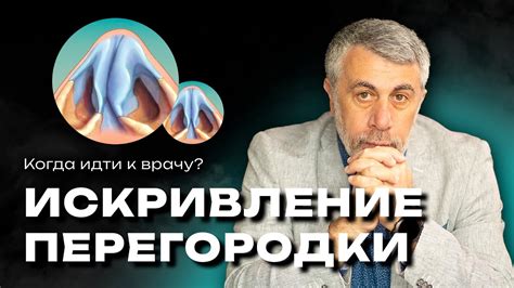 Профилактика и предотвращение искривления носовой перегородки