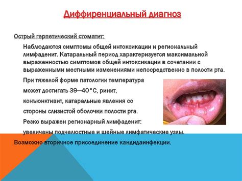 Психологические аспекты открытого рта у ребенка
