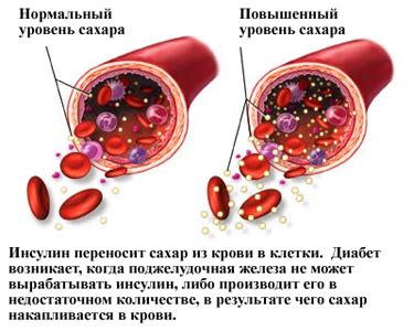 Психологический стресс и изменение уровня сахара в крови