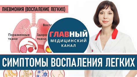 Раздел 2: Симптомы пневмонии без температуры