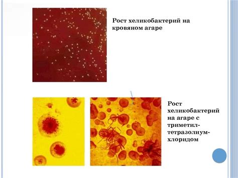 Распространение хеликобактера и его особенности