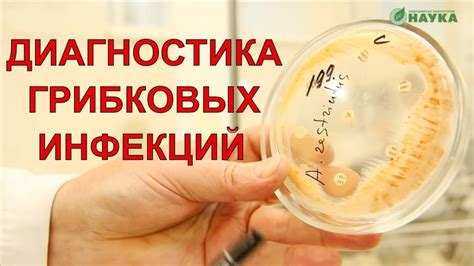 Распространенность грибковых инфекций в бассейнах