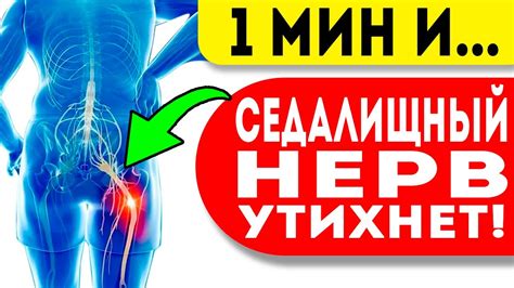 Распространенные заблуждения о возможности повредить седалищный нерв при уколах