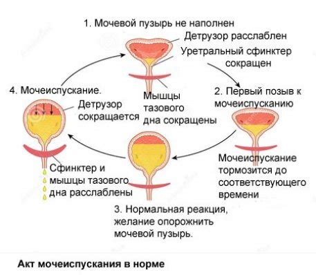 Расстройства мышц мочевого пузыря