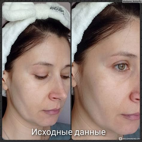 Регенерация кожи и устранение отека