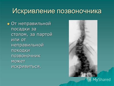 Результаты неправильной посадки
