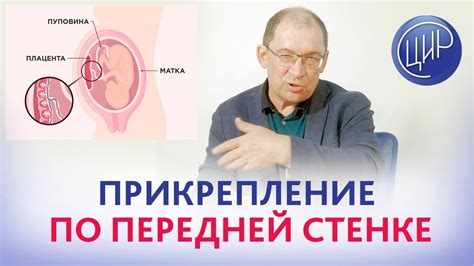 Рекомендации для беременных с хорионом по задней стенке