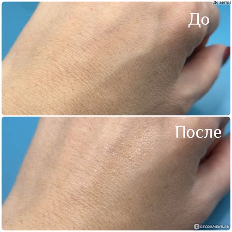 Рекомендации для повышения эффективности применения сыворотки