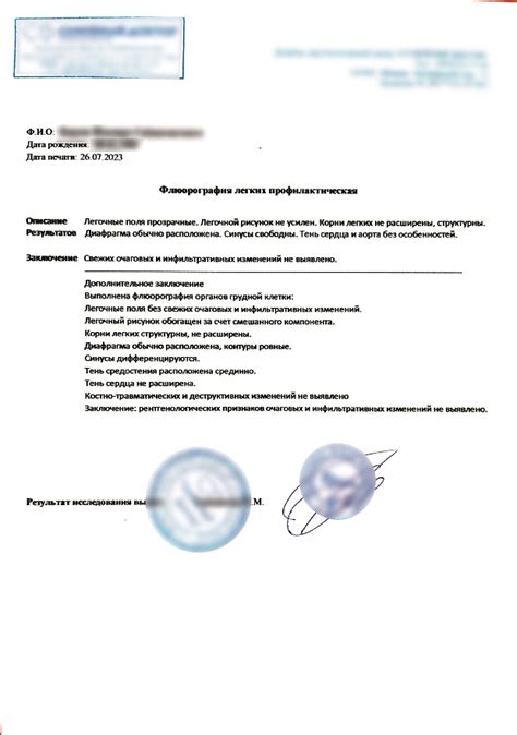 Рекомендации по проведению флюорографии без прописки