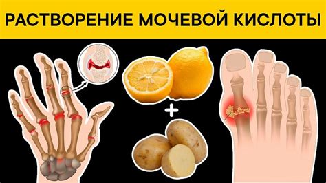Рекомендации по употреблению лосося при подагре