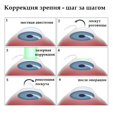 Рекомендации специалистов в области восстановления зрения